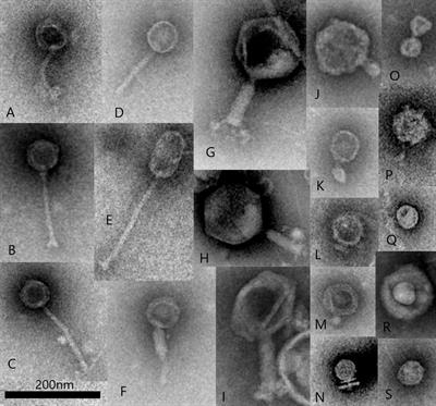 Rumen Virus Populations: Technological Advances Enhancing Current Understanding